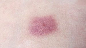 ЧТО БУДЕТ ЕСЛИ ПРОГЛОТИТЬ КЛЕЩА?!