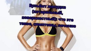 Бульбит желудка (катаральный, поверхностный): что это такое, симптомы, лечение