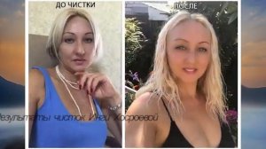 ДО И ПОСЛЕ ЧИСТОК. ВЕДЬМИНА ИЗБА ▶️ ИНГА ХОСРОЕВА