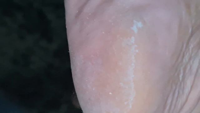 mature sole barefoot