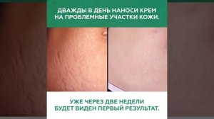 #Копеечные средства для красоты (из Аптеки )#