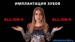 Имплантация зубов ВСЕ НА 6 лучше, чем ВСЕ НА 4? Все об ALL ON 6 - суть, этапы | Mednavigator.ru