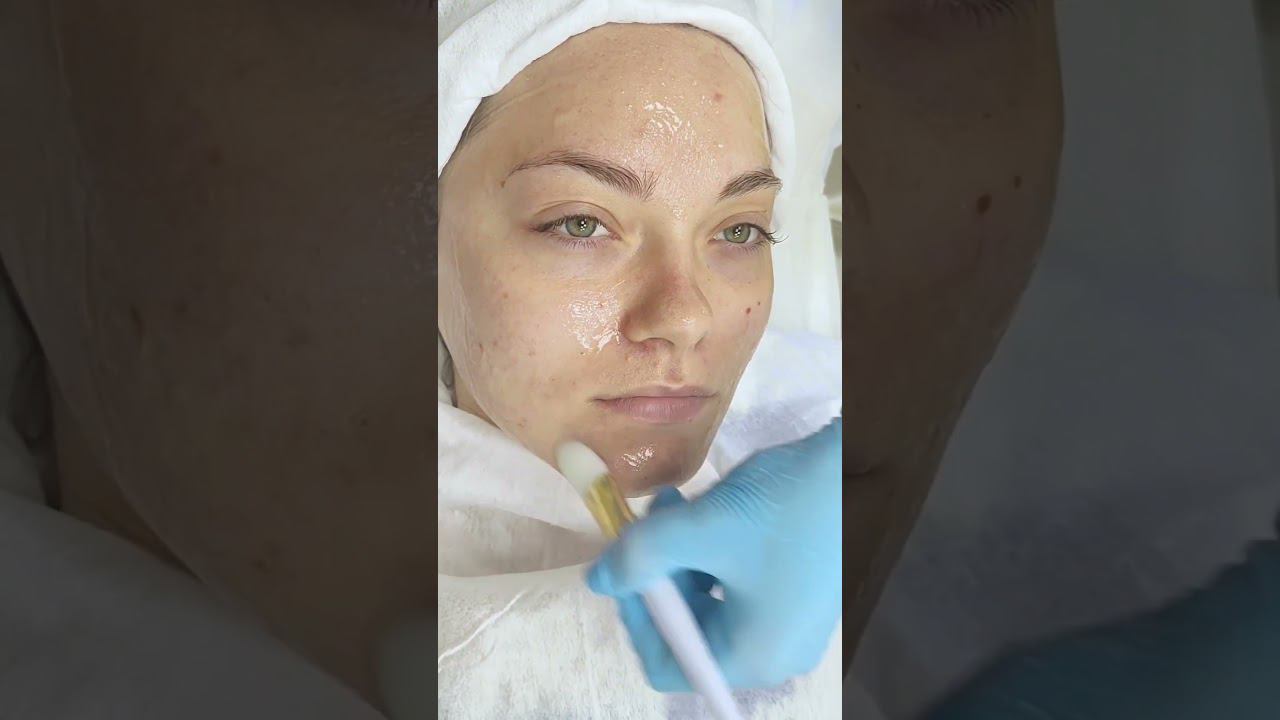 Механическая чистка лица смотреть онлайн