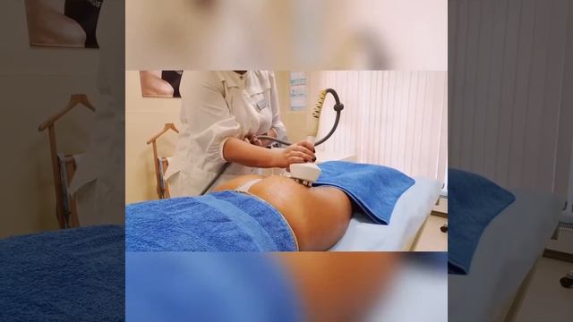 RF лифтинг ягодиц