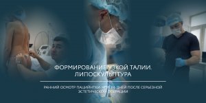 Формирование узкой талии - операция БЕЗ удаления ребер