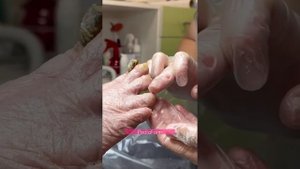 Работа с возрастным клиентом. Онихогрифоз ногтей. Педикюр в пожилом возрасте. Срезать толстые ногти
