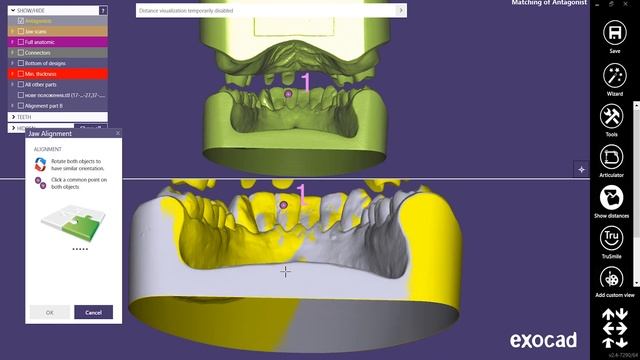 Exocad репозиция моделей. Видеоинструкция. смотреть онлайн