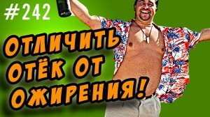 ожирение или отечность. как отличить жир от отека