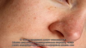Как избавиться от расширенных пор на лице? Маски и средства для сужения пор