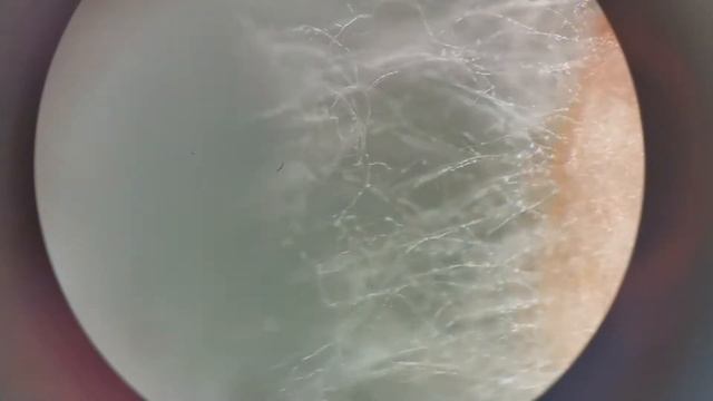 plant pathogenic fungus Rhizoctonia solani and soil microbiota under the microscope смотреть онлайн