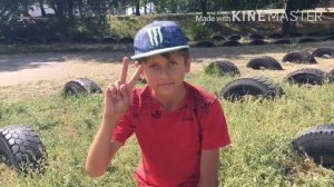 неудачный паркур. Подвернул ногу.