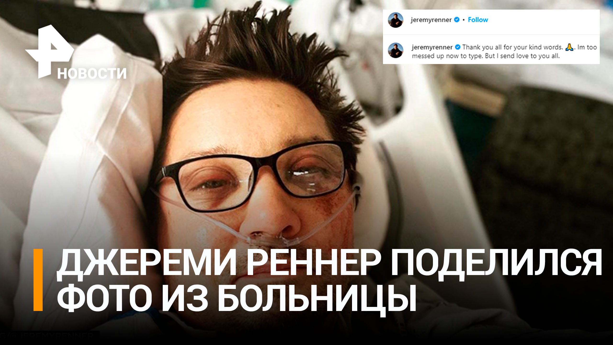 Звезда "Мстителей" опубликовал первое фото из больницы после трагедии / РЕН Новости