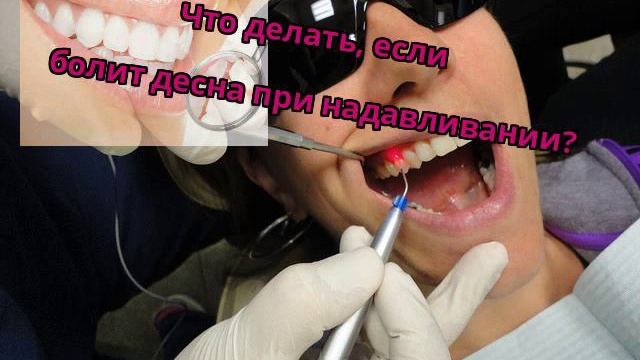 Что делать, если болит десна при надавливании? смотреть онлайн