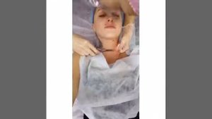 Установка микродермала