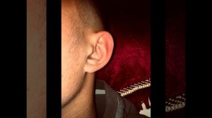 #миноксидил #борода Результаты за 1 месяц использование миноксидила !до и после