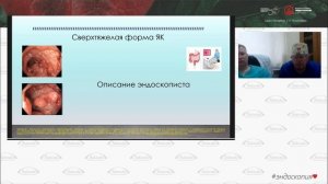 Сложные вопросы реальной клинической практики: взаимодействие врача гастроэнтеролога и эндоскописта