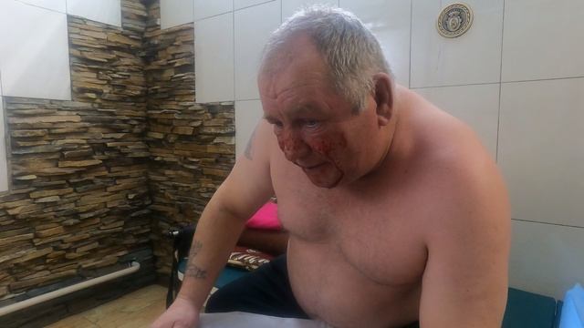 кровопускание с лица