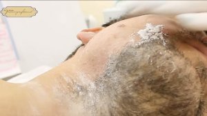 Мужской шугаринг.Лицо/Men's sugaring on the face