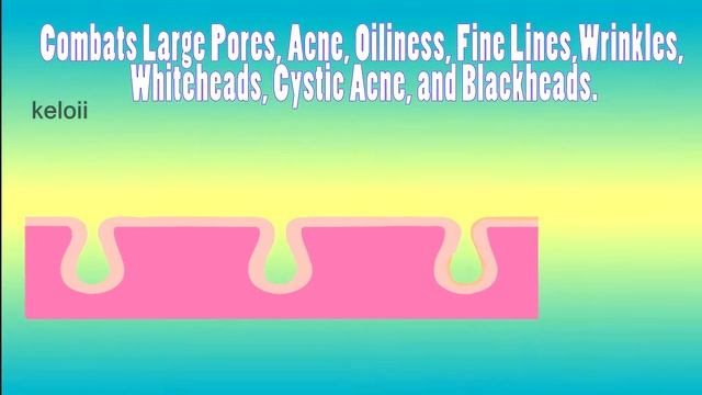 La Roche-Posay Effaclar Serum review смотреть онлайн