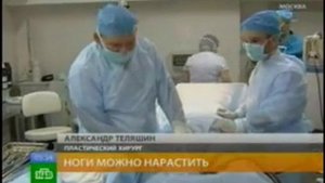 Удлинение ног в Beauty Plaza