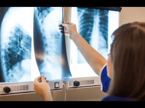 Еще двое пациентов могут быть жертвами «смертельного рентгена» в Петербурге
