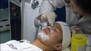 skin resurfacing, scars removal 10600nm fractional Co2 laser machine treatment video, Nubway