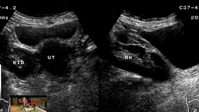 MY HEALTH MY LIFE ABDOMINAL SCAN смотреть онлайн