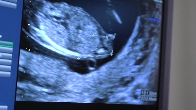 Определение пола будущего ребенка смотреть онлайн