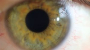 Close up eye and pupil dilation-DW2iwEshWME_x264