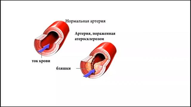 Вера ГУСАК "Кишечник - Зеркало Организма" смотреть онлайн