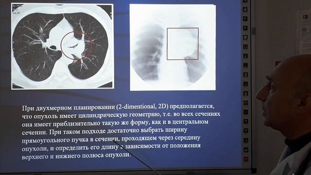 Лучевая терапия (часть вторая) для студентов 3 курса медицинских ВУЗов