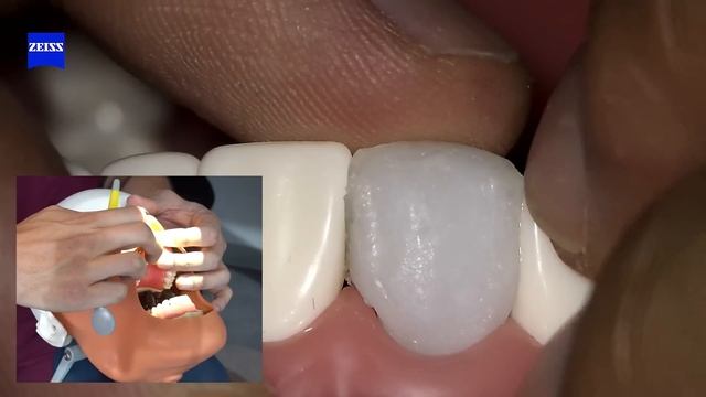 Pongo a prueba producto de Amazon para hacer DIENTES en casa. смотреть онлайн
