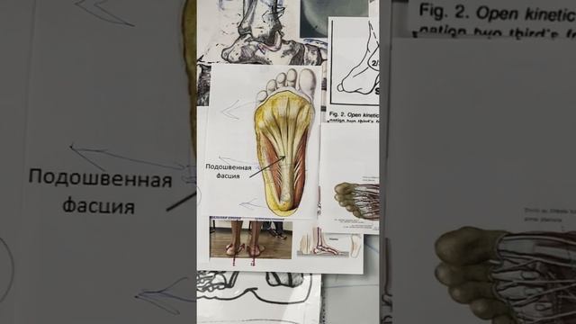 ОБУВЬ ПРИ ПЛОСКОСТОПИИ.???Почему стелька не работает если обувь не правильная?