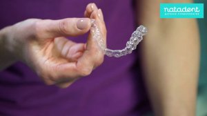 78. Что такое элайнеры для выравнивания зубов? Натадент