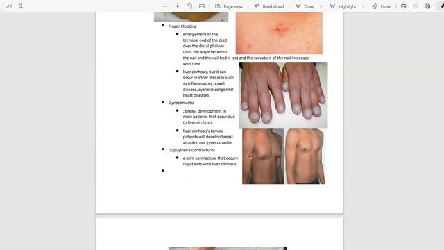 GIT PROBLEM BASED LEARNING смотреть онлайн