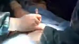 Пластика груди, круропластика. Пластический хирург Максим Осин