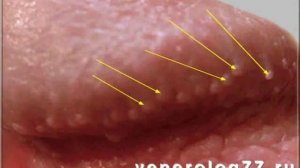 Перламутровые