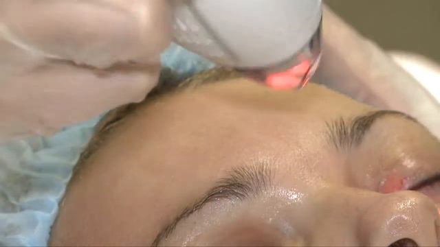 FINEPEEL смотреть онлайн