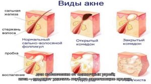 Ложка Уно для чистки лица