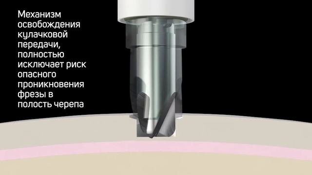 Краниальные перфораторы | ACRA-CUT | Auroramed