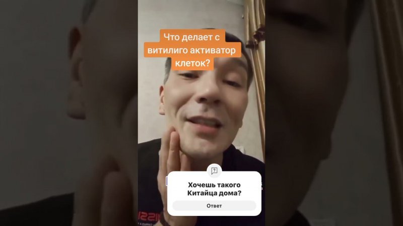 Отзывы Убрали витилиго с помощью активатора клеток Whieda Китайские технологии для бизнеса. #whieda