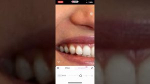 КАК ОТБЕЛИТЬ ЖЕЛТЫЕ ЗУБЫ НА ФОТО. Придожение Meitu