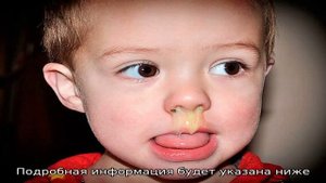 Почему появляются жидкие прозрачные сопли
