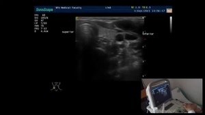 Право-/лево- ориентация на ультразвуковом сканере