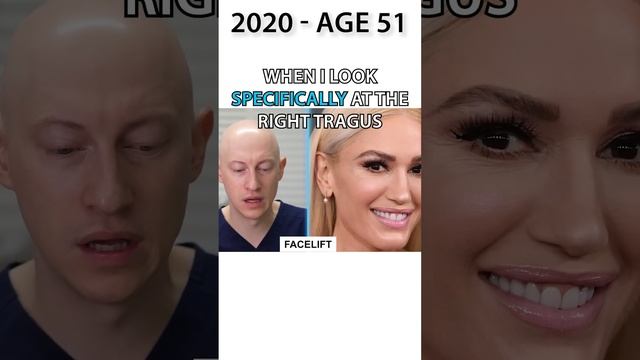 Gwen Stefani's NEW FACE