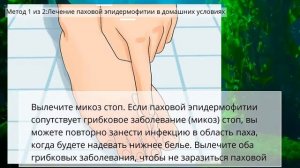 Как лечить паховую эпидермофитию - Подзалу*ный творожок