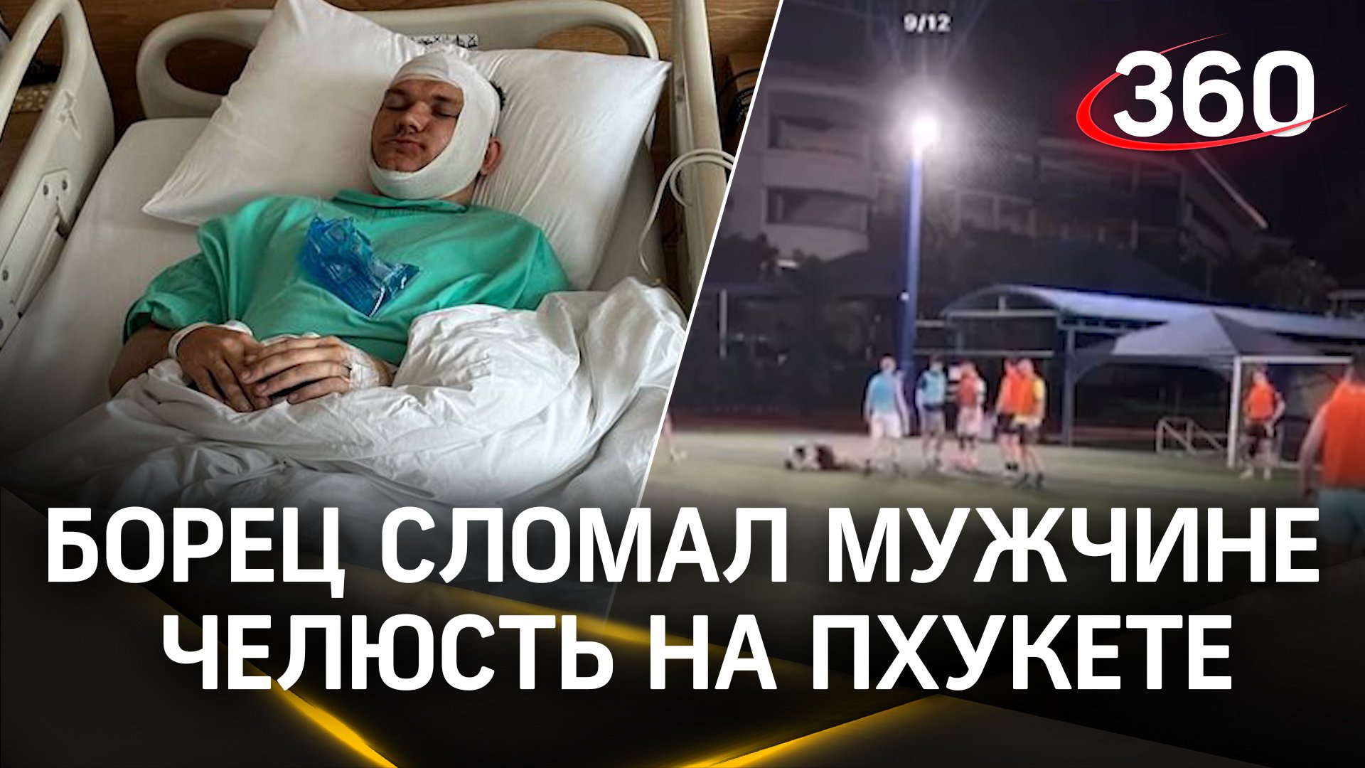 Миллион на «сборку» лица: борец сломал россиянину челюсть во время футбола на Пхукете