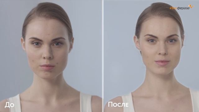Крем Имофераза - Уменьшает следы постакне смотреть онлайн