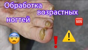 Обработка возрастных ногтей ⚠️?❗️??