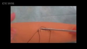 ? Медицина и хирургия - Техника наложения шва Мультановского